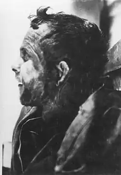 Left side profile of Johnson's corpse.
