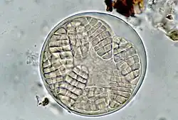 DIC micrograph of a round Arthothelium spectabile ascus, showing eight colourless muriform ascospores arranged radially