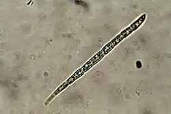 Acicular spore of B. schweinitzii, 65 x 6 micrometres, photographed through a compound microscope, x1000