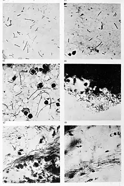Bacilli of malignant edema and in cornea of pox in sheep