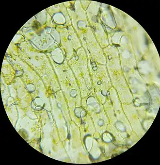 Celery tissue under 400× magnification