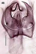 Male genitalia