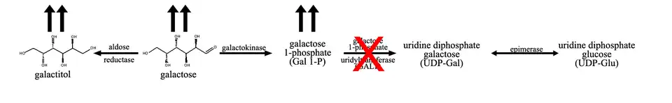 If the activity of the enzyme galactose 1-phosphate uridyltransferase is decreased, there is a buildup of the precursors in the pathway, mainly galactose 1-phosphate and galactose.