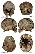 Burial 06 - Cranium