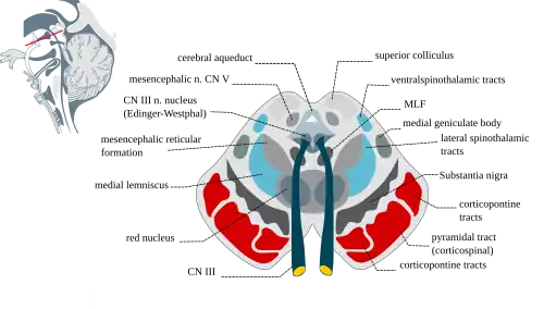 Cross-sectional anatomy of the midbrain showing location of the nucleus of the oculomotor nerve and the Edinger-Westphal nucleus