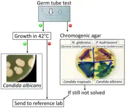 Algorithm for the diagnosis of Candida albicans versus differential diagnoses