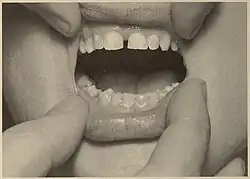Teeth