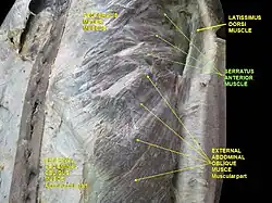 Serratus anterior muscle. Anterior thoracic wall. External abdominal oblique muscle. Deep dissection, anterior view.